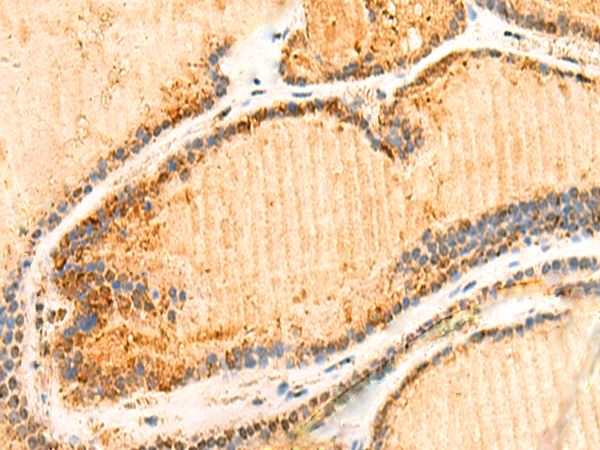 ZNF581 Antibody