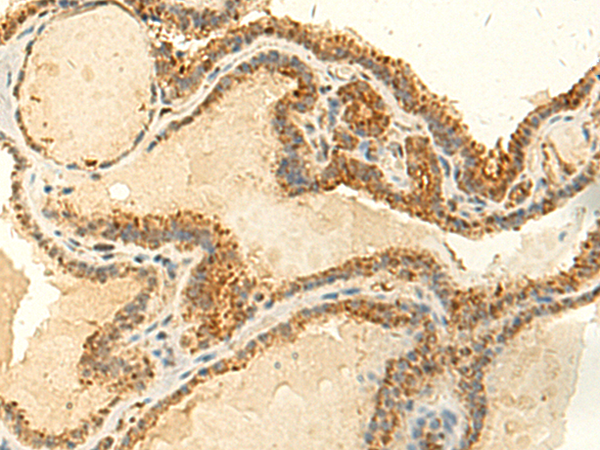 MTHFS Antibody