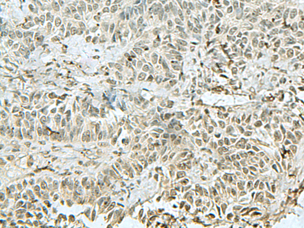THTPA Antibody