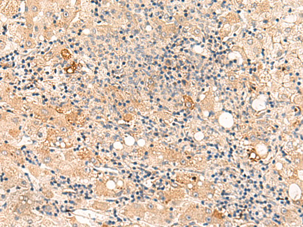 SULT4A1 Antibody