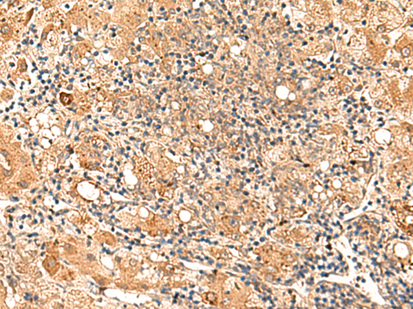 GALNT12 Antibody