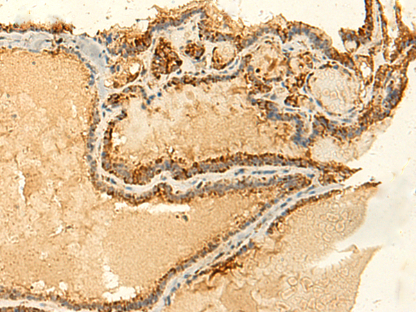 GLYATL2 Antibody