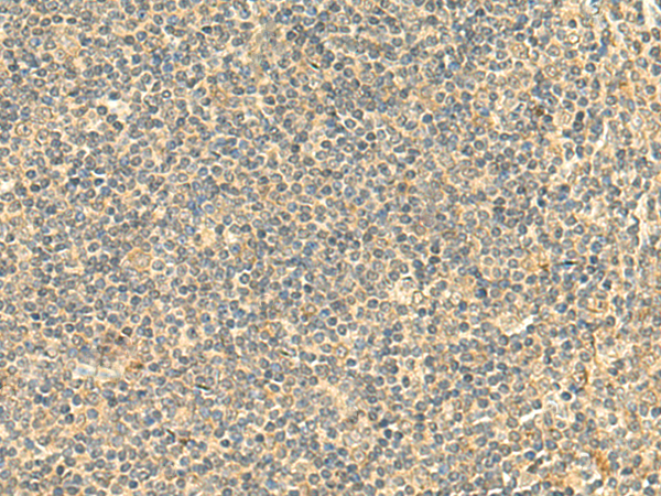 NTAN1 Antibody