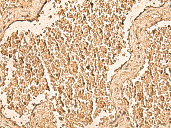 WDR33 Antibody