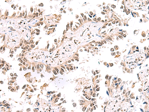 KCTD13 Antibody