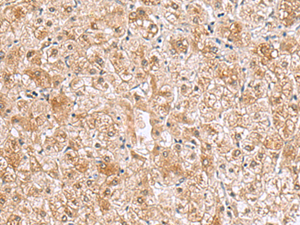 RTKN2 Antibody