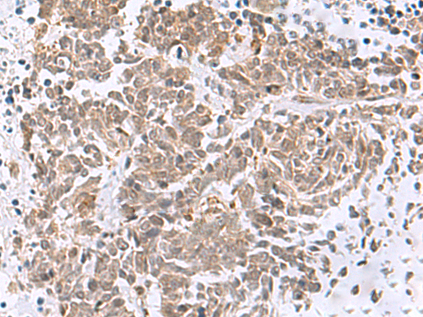 RBFOX2 Antibody