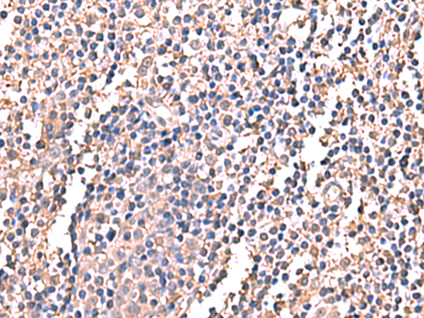LDHAL6B Antibody