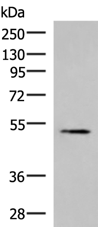 TUBB2A Antibody