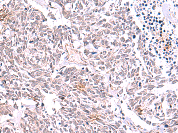 TRMT12 Antibody
