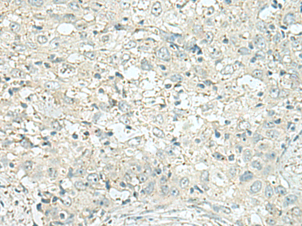 DENND6A Antibody