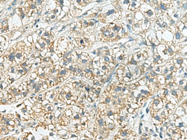 SORBS2 Antibody