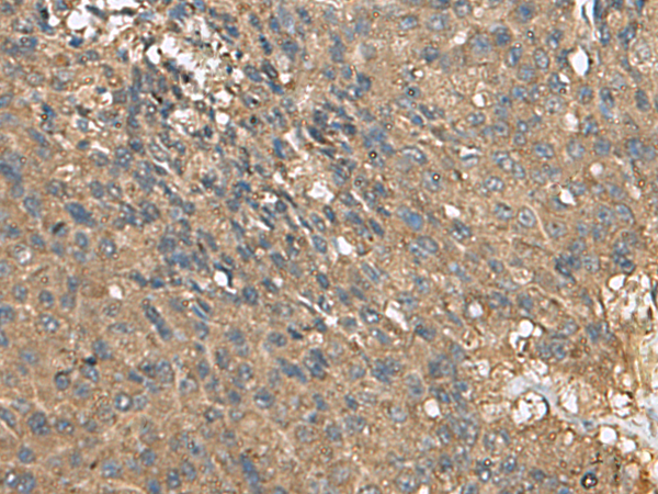EIF1AX Antibody