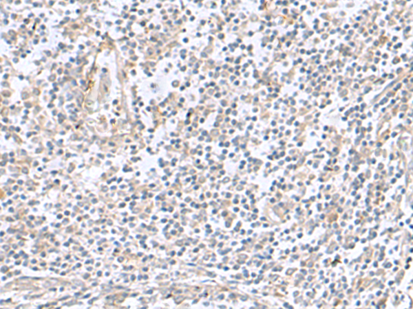 TNNC2 Antibody