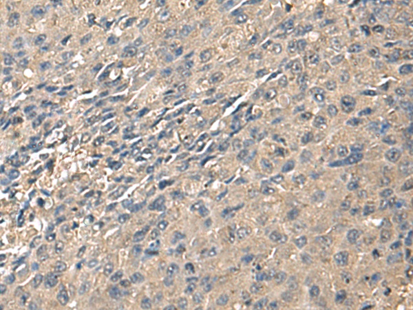 ZG16 Antibody