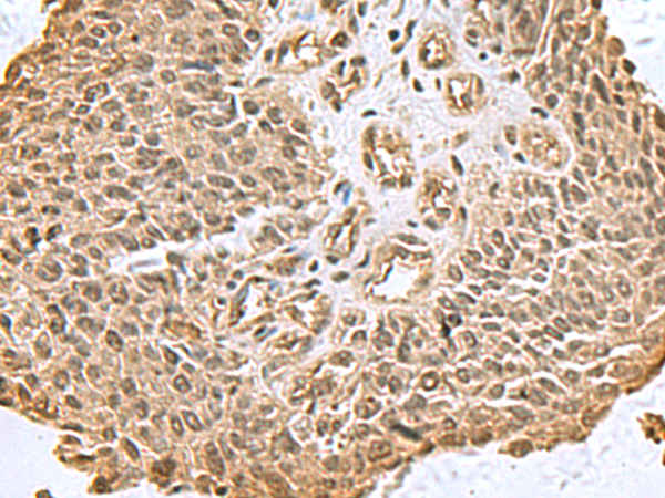 DCTPP1 Antibody
