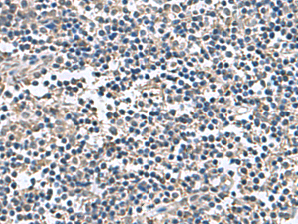 BLOC1S6 Antibody