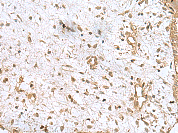 AK6 Antibody