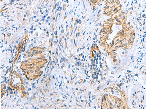 NMU Antibody