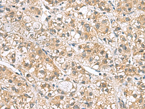 PPIH Antibody