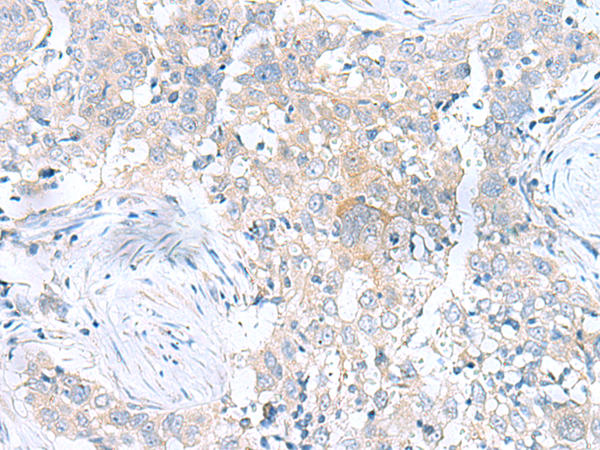 UBE2F Antibody