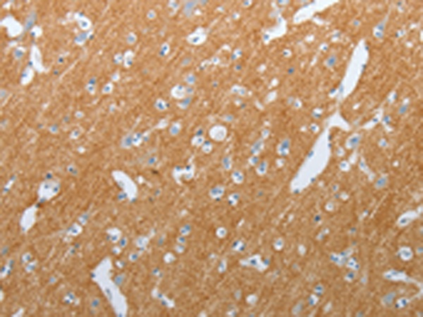 SLC17A7 Antibody