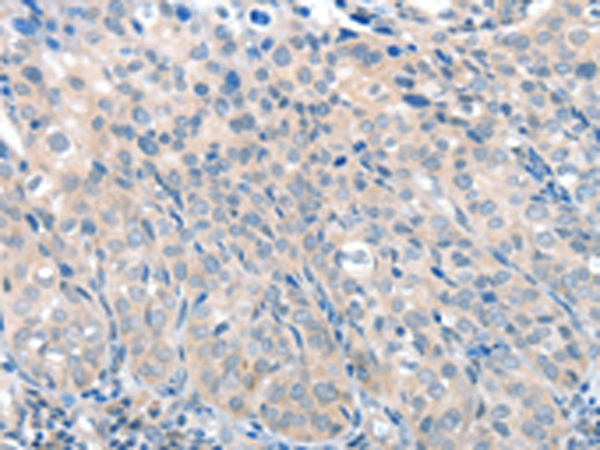 SLC17A6 Antibody