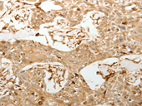 VMA21 Antibody