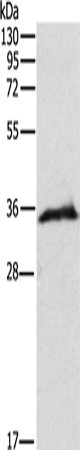 WBP2 Antibody