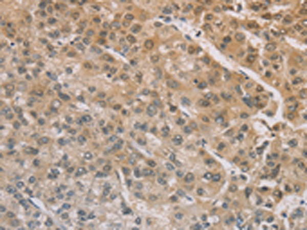 ZIC2 Antibody
