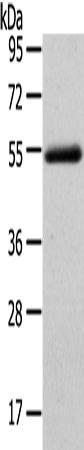 FOXC1 Antibody