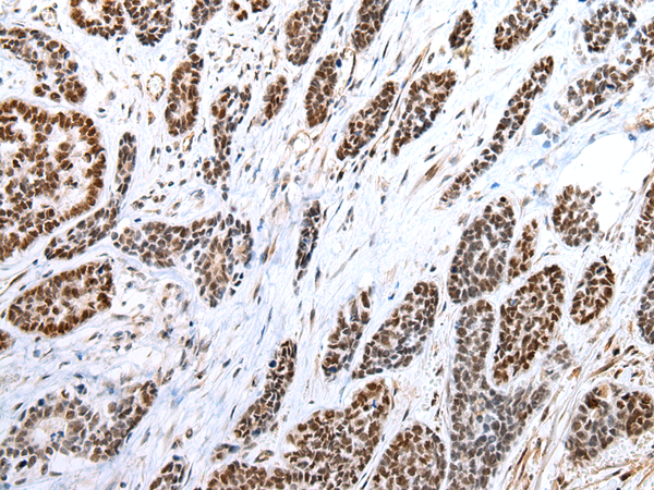 FOXP1 Antibody