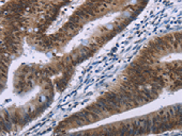 HMGA1 Antibody