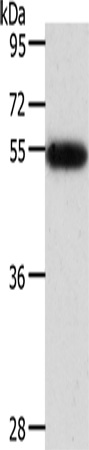 AGT/Angiotensin Antibody