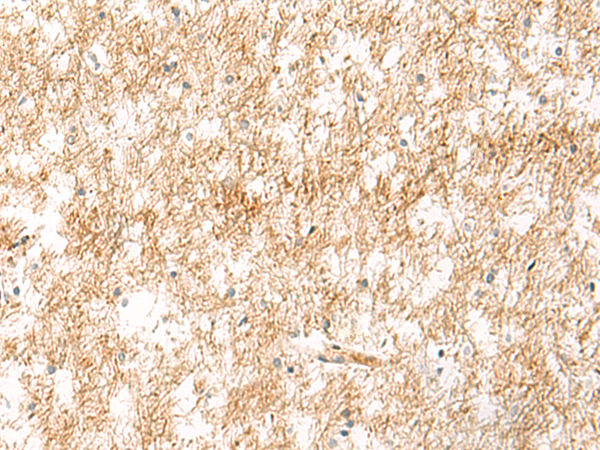 XPC Antibody
