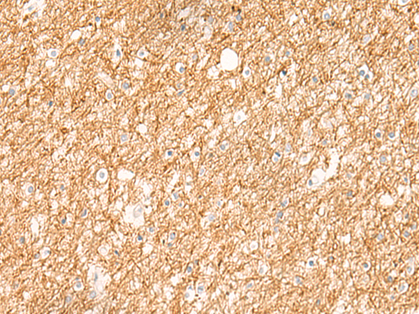 ZNF185 Antibody