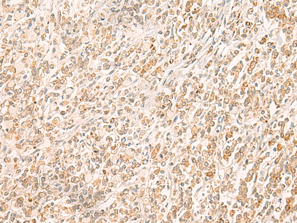 MYCT1 Antibody