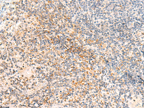 CLDN16 Antibody