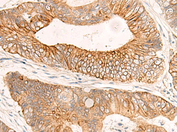 ABHD2 Antibody