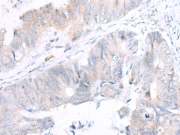 NUDT8 Antibody