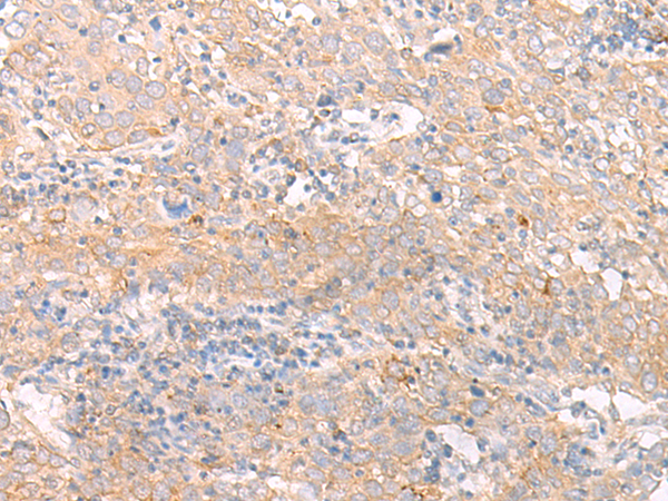 IFNL1 Antibody