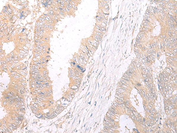 HLA-C Antibody