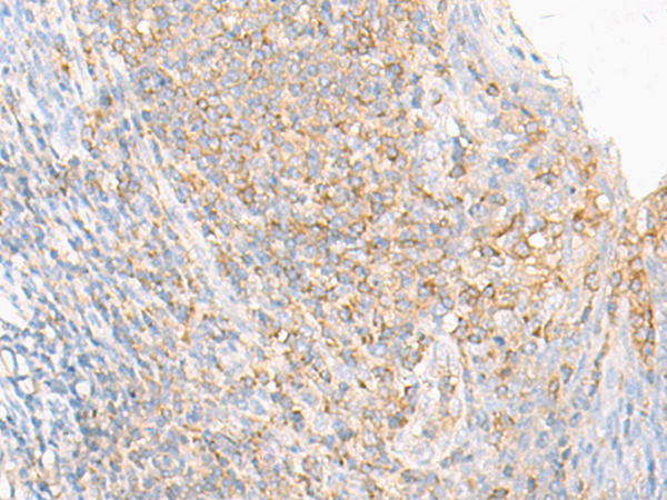 ERAP2 Antibody