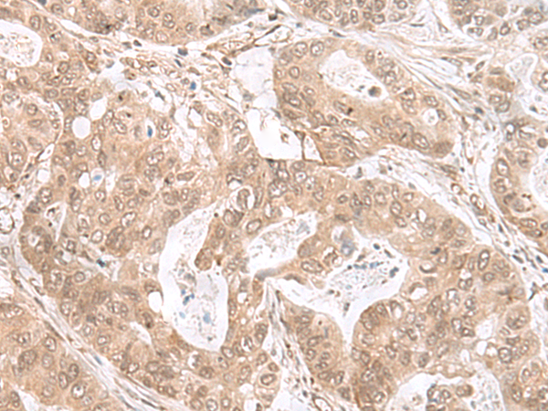 ETV3 Antibody