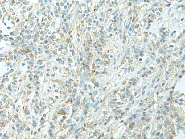 EVI2B Antibody