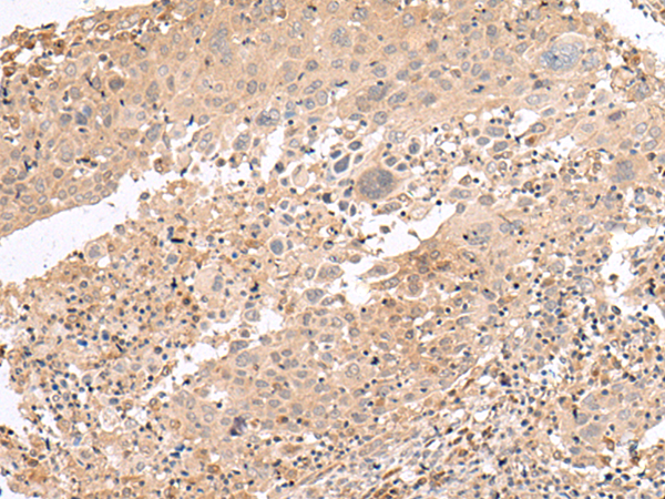 PATJ Antibody