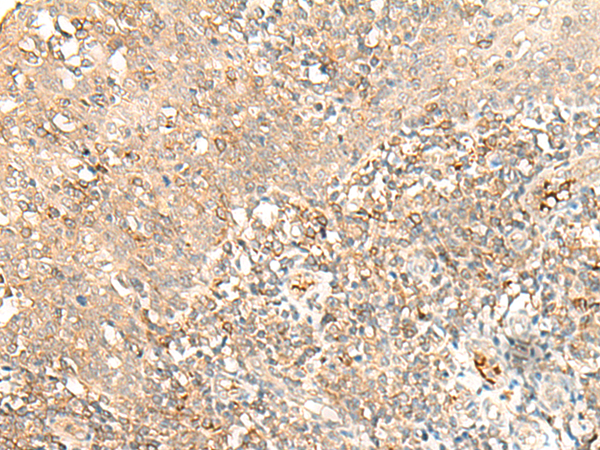 MOB3B Antibody