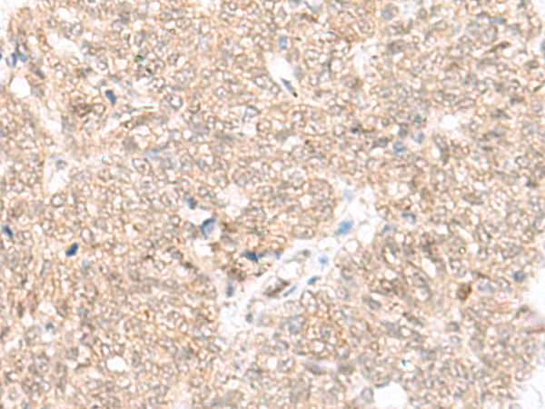 FAM111B Antibody