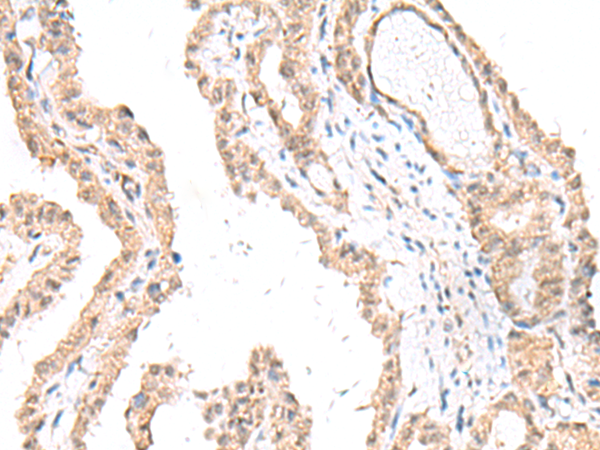 FANCE Antibody