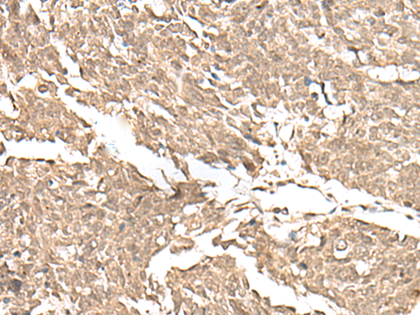 KDM2A Antibody